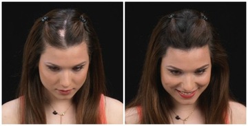 Kmax Microfibers для утолщения волос, 5 г, кератиновые волокна, натуральный, средний, коричневый