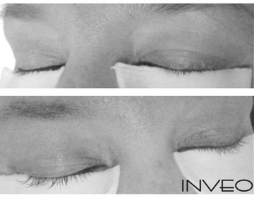 Сыворотка, ускоряющая рост ресниц, гипоаллергенный кондиционер для ресниц INVEO.