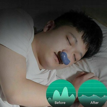 Микроэлектрическое устройство против храпа Cpap Noise
