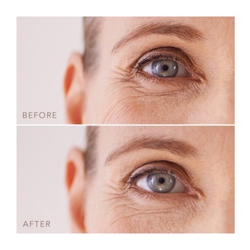 Гидрогелевая маска для глаз FOREO IRIS