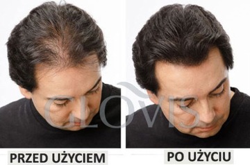 GLOVIS Shader 2w1 Gęsta Ciemna Broda Zagęszczanie Przyciemnia Zarost