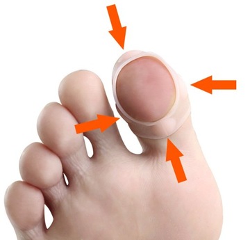 Силиконовые ленты для вросших ногтей, 2 шт., № WrP1.