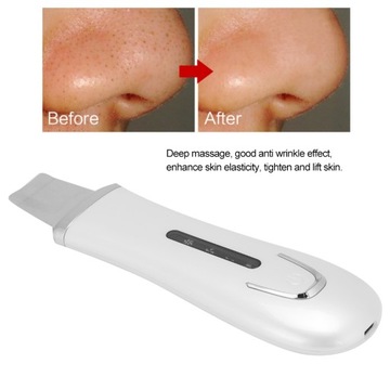 Ультразвуковой пилинг кожи лица Удаление