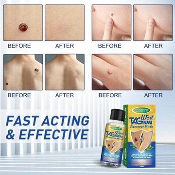 10 мл жидкость для лечения бородавок на теле, жидкость для удаления бородавок, анти