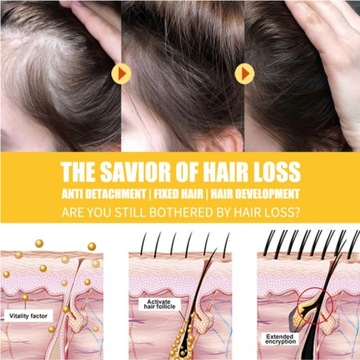 Крем для роста волос с имбирем, лечение выпадения волос