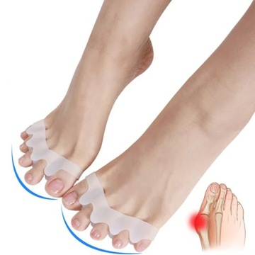 1 пара разделителей пальцев ног, коррекция Hallux Valgus Corr
