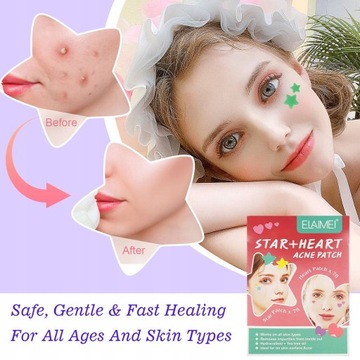 ГИДРОКОЛОЛИДНЫЕ ПАТЧИ ОТ Прыщей и прыщей