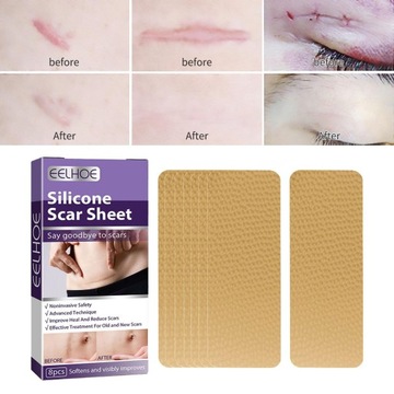 Силиконовая лента в листах, смягчение старых и новых