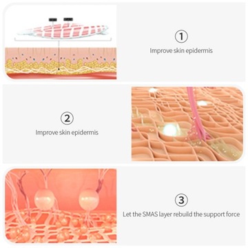 HIFU Multifunction Skin Care Ultrasonic FaceBeauty