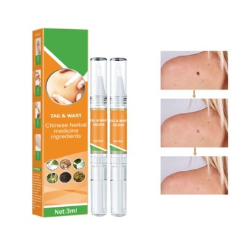 Средство для удаления бородавок и кожных меток 3 мл