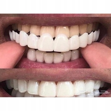 Силиконовый гель Snap on Perfect Smile Dental Hygiene