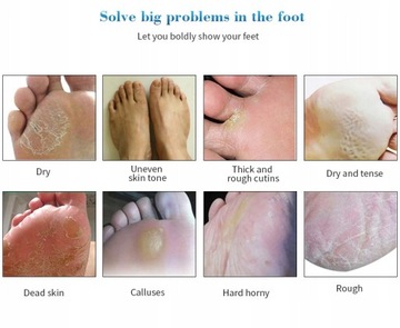 Носки с маской для ног, отшелушивающие мозоли, мертвые