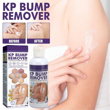 EELHOE Removal Cream Skin Repair Deep Moisturize