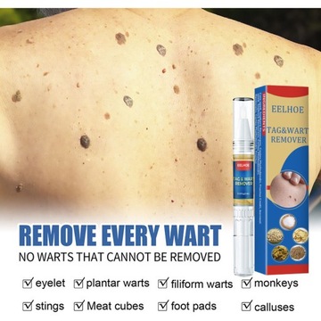 Средство для удаления бородавок и кожных меток