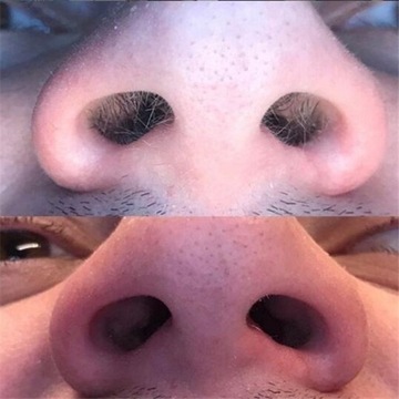 ZESTAW WOSK DO DO WOSKOWANIA DEPILACJI NOSA USZU MĘŻCZYZNA KOBIETA PATYCZKI