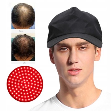 USB-шапка для роста волос, средство для контроля масла