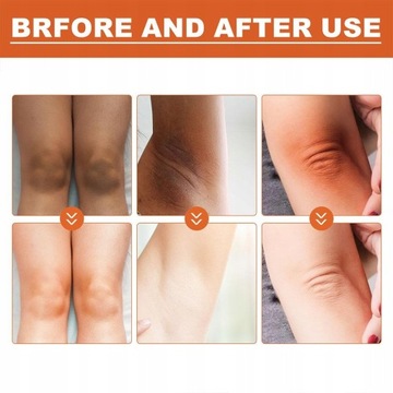 Отбеливающая сыворотка для удаления темных костяшек пальцев