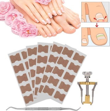 НАБОР НАКЛЕЙКОВ-ПАТЧЕЙ ДЛЯ КОРРЕКЦИИ ВРОСШИХ НОГТЕЙ 50шт. ЗАЖИМ ДЛЯ ЗОНДА