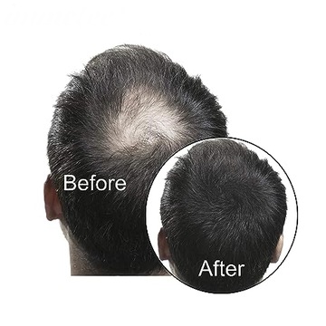 Микроволокна Густые волосы за 30 секунд Маскируют облысение.