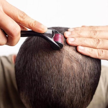 ДЕРМА РОЛИК для волос для роста волос уменьшает облысение кожи головы