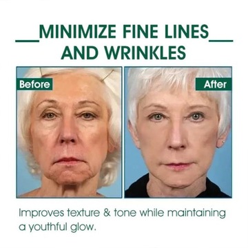 Омолаживающая сыворотка Fubsta Skin Firming, Сыворотка FubstaFacial, Укрепление кожи