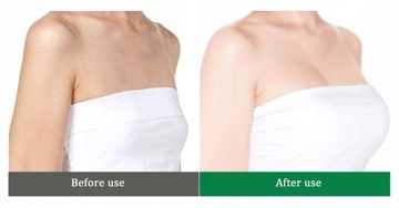 Крем для увеличения груди способствует выработке женских гормонов