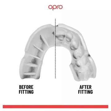 КОРОБКА ДЛЯ ЗАЩИТЫ РТА OPRO БЕЛАЯ ЗАЩИТНЫЙ СЛОЙ UFC JAWS