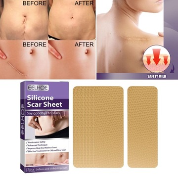 Силиконовая лента в листах, смягчение старых и новых