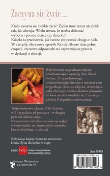 KAUSZA STALOWA OCYNKOWANA 3 MM 4 SZT