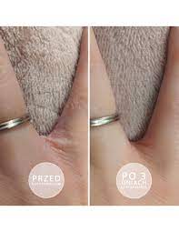 ИНТЕНСИВНО ОВСЯТАЮЩАЯ МАЗЬ с витамином Е