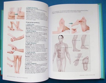 Практическое руководство по установке банок Чжунчао.