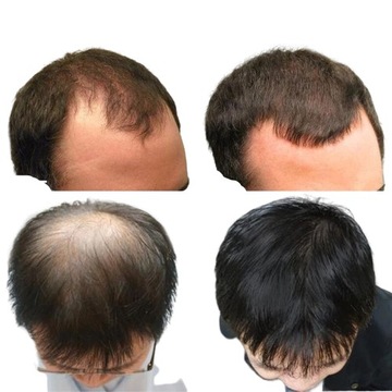 ВАЛИЦ ВАЛИЦ ДЛЯ БОРОДЫ, ВАЛИЦ ДЛЯ УПЛОТНЕНИЯ