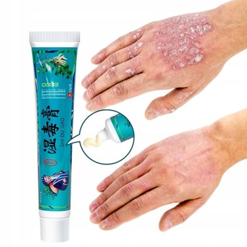 Psoriasis Medical Cream Skin Care