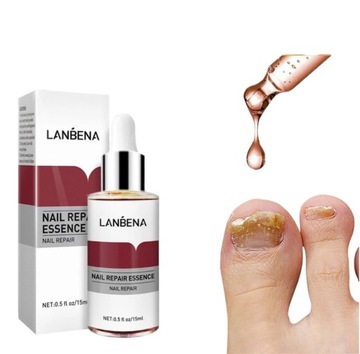 Грибок ногтей Strong Nail Repair Liquid