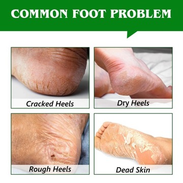 Aliver Tea Tree Refite Balm-бальзам на потрескавшихся каблуках с чайным кустарником 70G