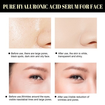 Набор для лифтинга Essence Protein