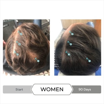 spectral DNC-S na łysienie uzupełn.szamponu REVITA