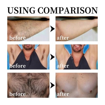 Men's hair removal cream Body Skin care armpit Beard remover Legs Arms