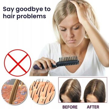 Спрей для роста волос, которые быстро растут против выпадения