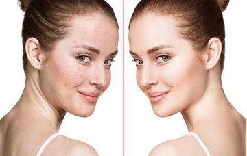 DERMA WAND ДАРСОНВАЛЬ 4 ЭЛЕКТРОДА POWERFUL PRO