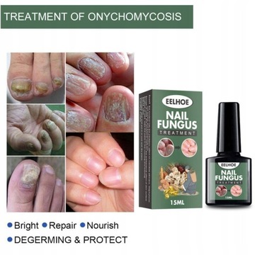 Nail Repair Essence Грибковая сыворотка 10 мл