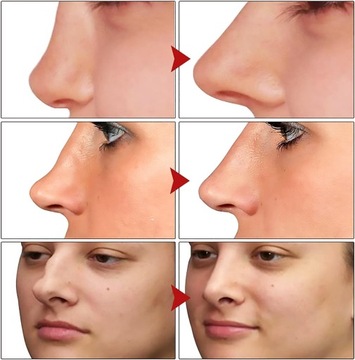 NOS ВЫСШЕЕ МАСЛО ДЛЯ МАССАЖА И УВЛАЖНЕНИЯ НОСА - 10 МЛ