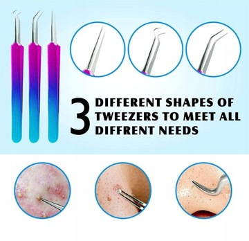 ZESTAW ŁYŻECZKI UNNY USUWANIE ZASKÓRNIKÓW WĄGRÓW