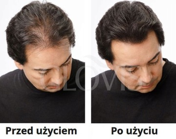 GLOVIS Hair MakeUp Topical Shader Маскирующая пудра