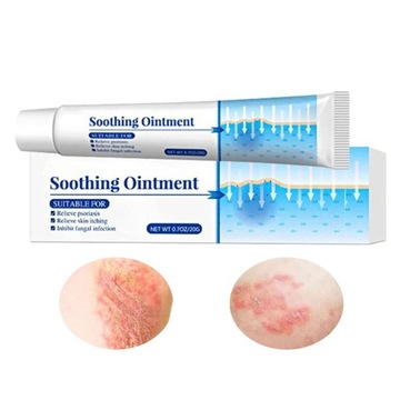 Skin Psoriasis Soothing Ointment 20g