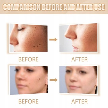 Средство для удаления бородавок и кожных меток 3 мл