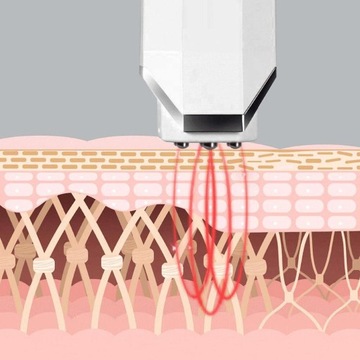 inFace RF Beauty АППАРАТ ДЛЯ ЛИФТИНГА ЛИЦА