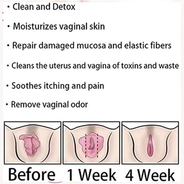 Dexca Natural - Dexca Capsules, Natural Repair Vagianal Capsules, Firming