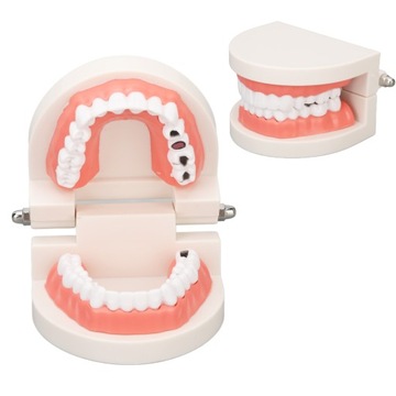 EDUKACYJNY MODEL ZĘBÓW DENTYSTYCZNYCH