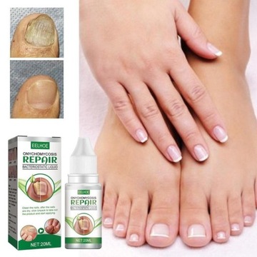 Грибок ногтей Strong Nail Repair Liquid 20 мл